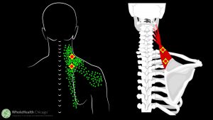 Trigger Point Therapy